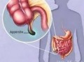 阑尾炎吃小瓜