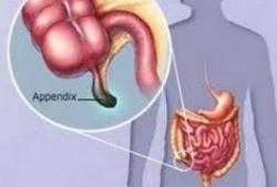 阑尾炎吃小瓜